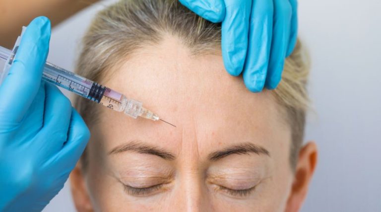 woma being injected of sculptra on forehead